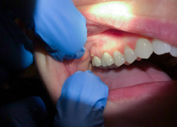 Best Emergency Cosmetic Dentistry (e.g., broken veneers) in Oak Creek, WI